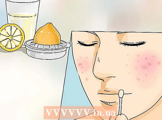 Cómo deshacerse o curar el acné