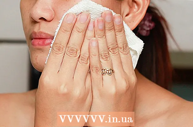 Hoe zich te ontdoen van acne met huismiddeltjes?