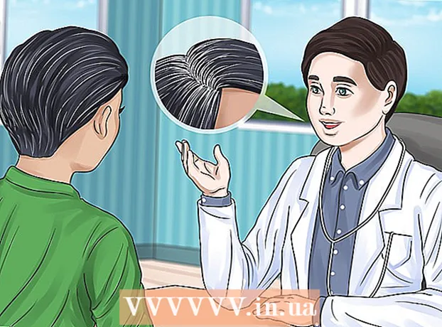 Como se livrar dos cabelos grisalhos