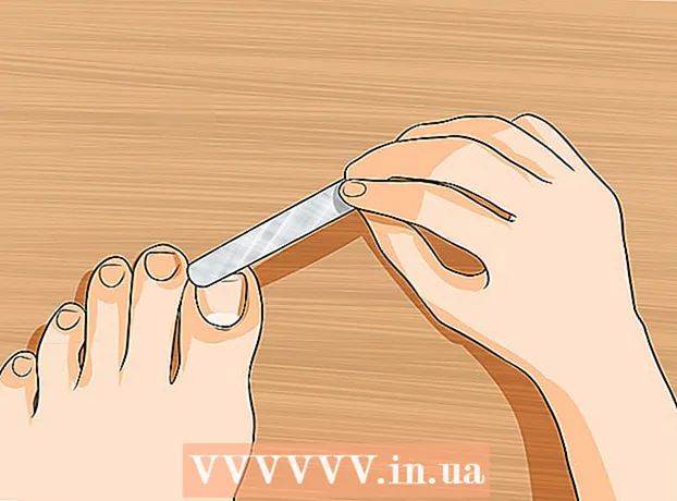 How to get rid of yellow toenails
