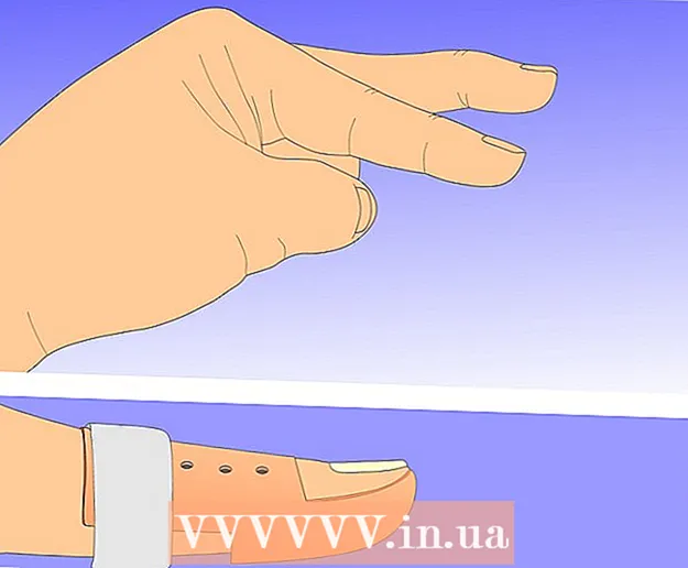 如何用夹板治疗远端指间关节水平的伸肌装置损伤