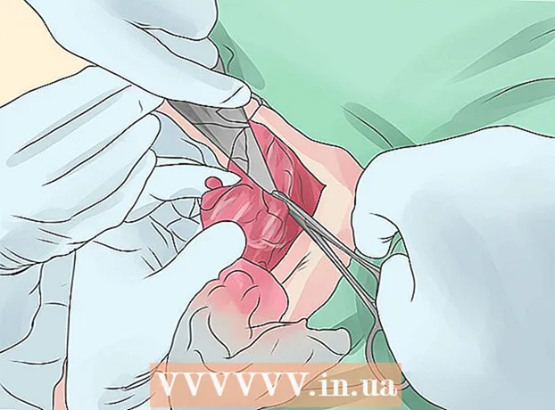 Как да се лекува дислокиран диск в шийния отдел на гръбначния стълб