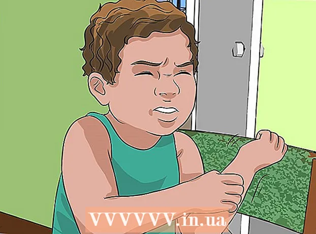 Kako zdraviti lišaje pri otrocih