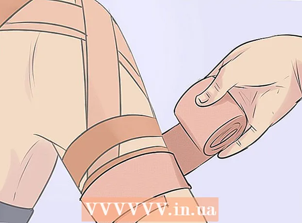 How to bandage a dislocated shoulder