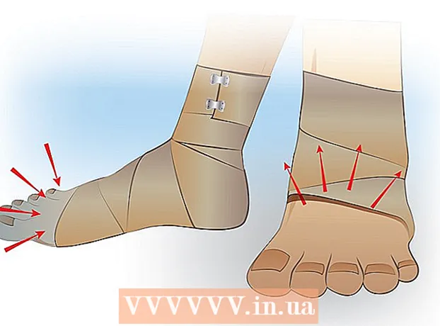 Como aplicar uma bandagem elástica na perna
