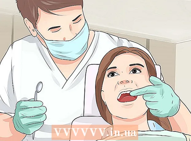 Як полегшити свій стан при ретенірованних зубі мудрості