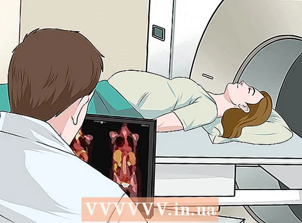 Cómo identificar la apendicitis durante el embarazo.