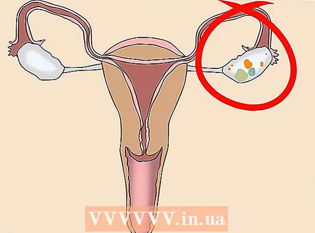 Hvordan avgjøre om en ovariecyste er tilstede