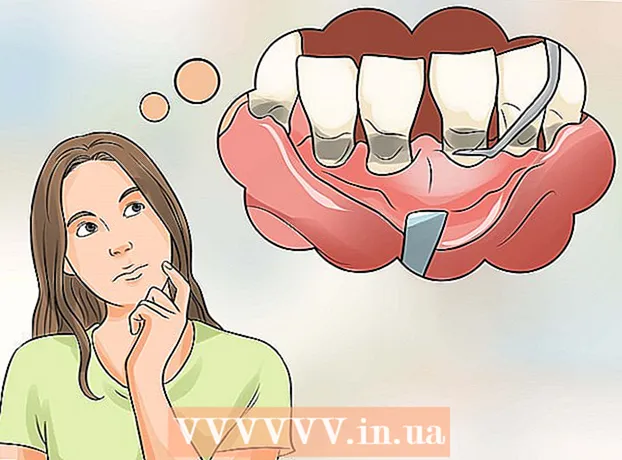 How to stop itchy gums