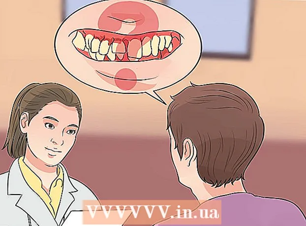 Як повністю очистити порожнину рота