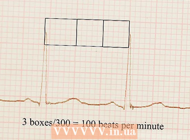 Kako prebrati EKG