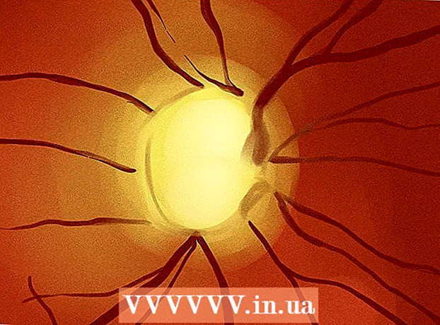 כיצד ניתן לבצע בדיקת עיניים