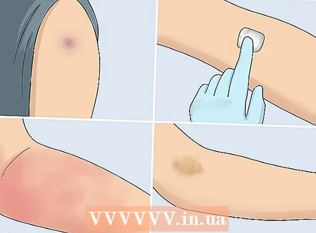 How to inject into a vein