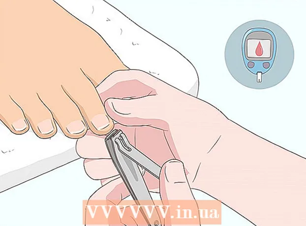 Come alleviare il dolore da un'unghia incarnita