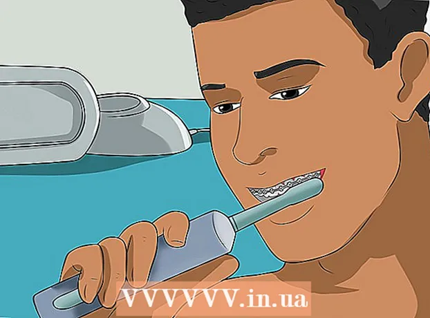วิธีถอดเหล็กจัดฟันก่อนกำหนด