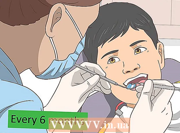 Как да премахнете зъбния камък
