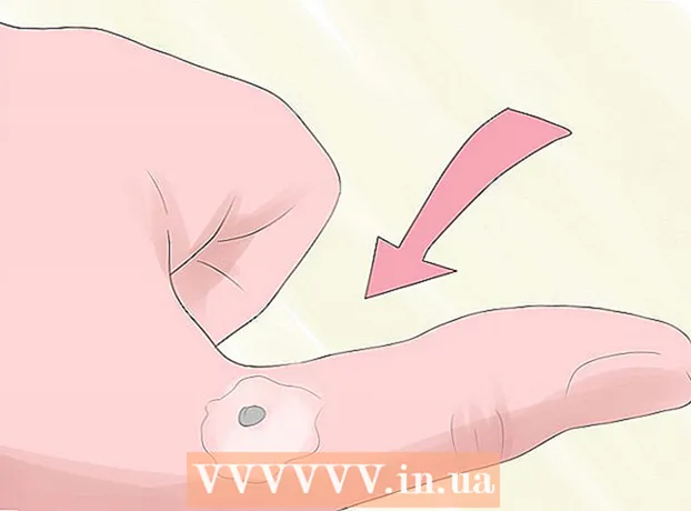 Como remover uma verruga usando sal epsom ou narcisos