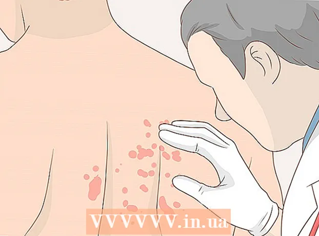 Како се бринути за кожу након шугаринга