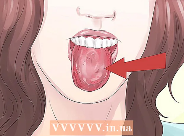 Sådan ved du, om du har gastritis
