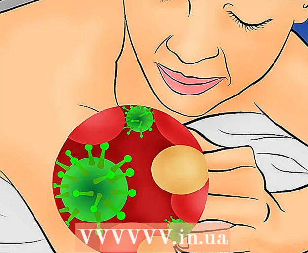 Come curare l'eczema