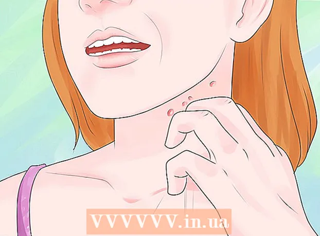 모낭염을 치료하는 방법