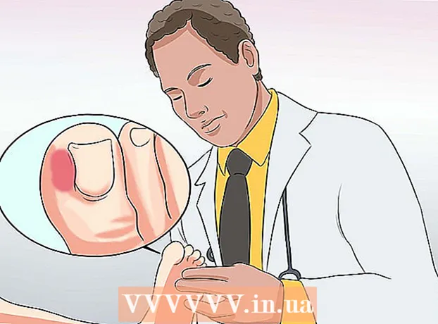 Cómo tratar una infección en un dedo del pie