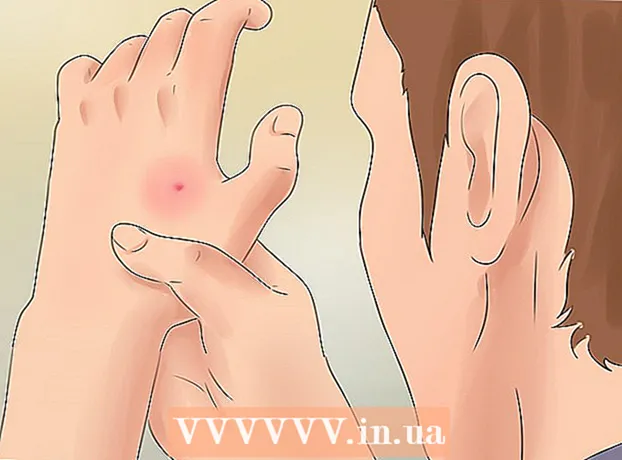 How to cure a spider bite
