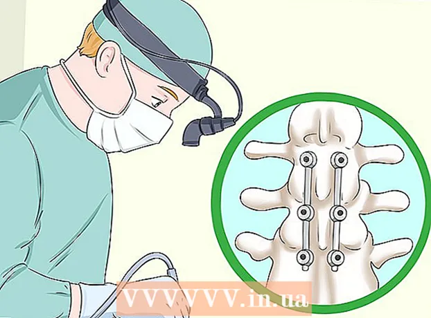 Cum să vă îndreptați coloana vertebrală