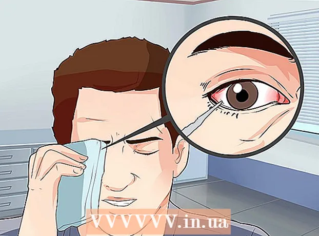How to get a speck out of your eye