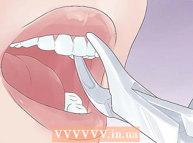 Si të mbroni një dhëmb të copëtuar